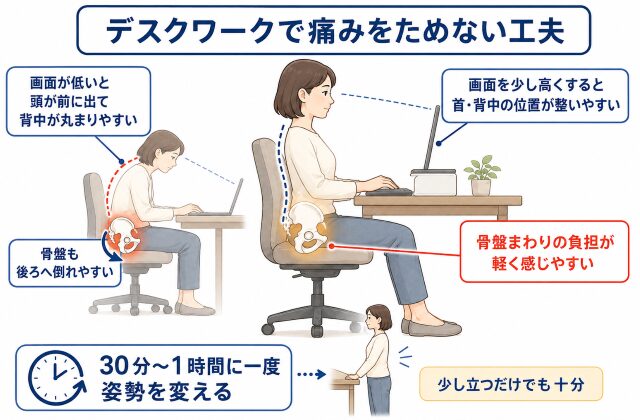 仙腸関節炎の人が気を付けるデスクワークでの姿勢